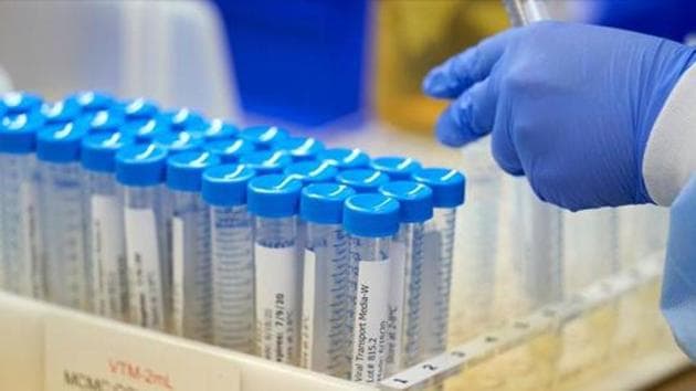 The minister and his wife were tested after they showed symptoms of Covid-19. (Representative photo/REUTERS) The minister and his wife were tested after they showed symptoms of Covid-19. (Representative photo/REUTERS)