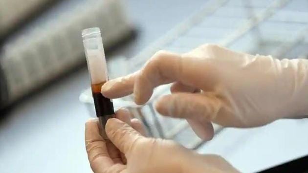The revised guidelines do not recommend testing of donated blood and blood components for Covid-19 or opting for more advanced Pathogen Reduction Techniques (PRT).(File photo for representation) The revised guidelines do not recommend testing of donated blood and blood components for Covid-19 or opting for more advanced Pathogen Reduction Techniques (PRT).(File photo for representation)
