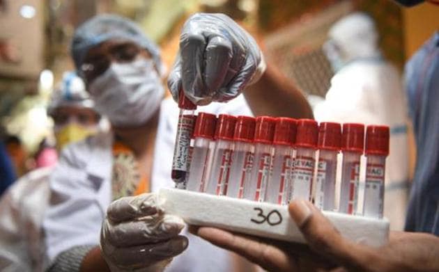 Of the total 960 cases in Ludhiana district, 433 have recovered and completed the post-discharge quarantine period. (/HT PHOTO) Of the total 960 cases in Ludhiana district, 433 have recovered and completed the post-discharge quarantine period. (/HT PHOTO)