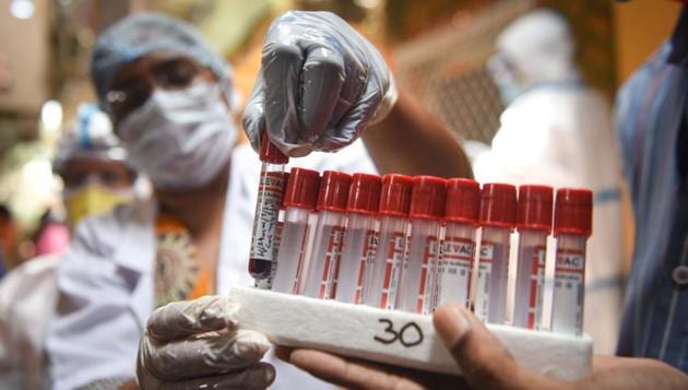 Early detection and timely clinical management of Covid-19 cases have resulted in better daily recoveries, with the recovery rate of coronavirus patients crossing 60 per cent in the country on Friday, the Union health ministry said.(HT PHOTO.) Early detection and timely clinical management of Covid-19 cases have resulted in better daily recoveries, with the recovery rate of coronavirus patients crossing 60 per cent in the country on Friday, the Union health ministry said.(HT PHOTO.)