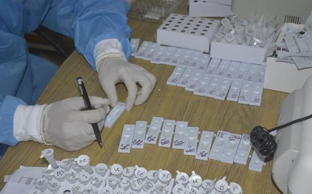 As many as 389 patients have recovered in Chandigarh, while six have succumbed to the virus. (HT File Photo) As many as 389 patients have recovered in Chandigarh, while six have succumbed to the virus. (HT File Photo)