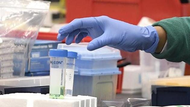 One of the labs under the Telangana government’s scanner showed a positivity rate of almost 72% in tests for Covid-19 which is highly unlikely. (Representative Photo/AP) One of the labs under the Telangana government’s scanner showed a positivity rate of almost 72% in tests for Covid-19 which is highly unlikely. (Representative Photo/AP)
