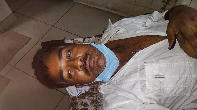 Daya Shankar Agnihotri, an alleged accomplice of main accused in the Kanpur encounter case, Vikas Dubey, at a hospital after being arrested, in Kanpur. (PTI) Daya Shankar Agnihotri, an alleged accomplice of main accused in the Kanpur encounter case, Vikas Dubey, at a hospital after being arrested, in Kanpur. (PTI)