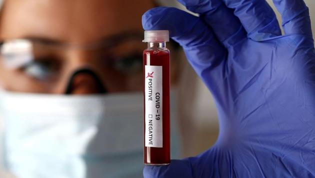 FILE PHOTO: Fake blood is seen in test tubes labelled with the coronavirus (COVID-19). (Representational) (REUTERS)