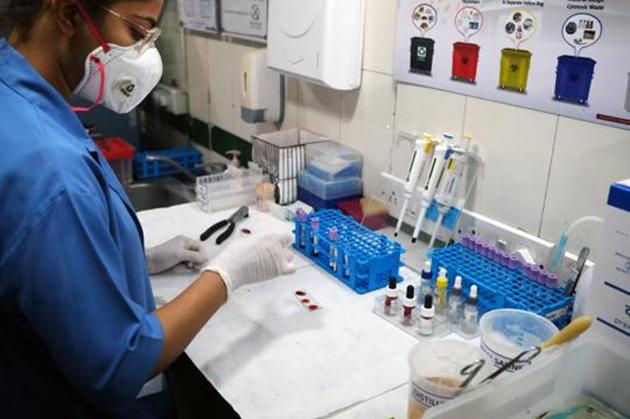 As many as 253 patients in Mohali district have recovered, while six have died due to the virus in the past four months.(Representative photo) As many as 253 patients in Mohali district have recovered, while six have died due to the virus in the past four months.(Representative photo)