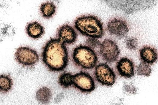 The district now has 362 confirmed cases of coronavirus disease.(File Photo)