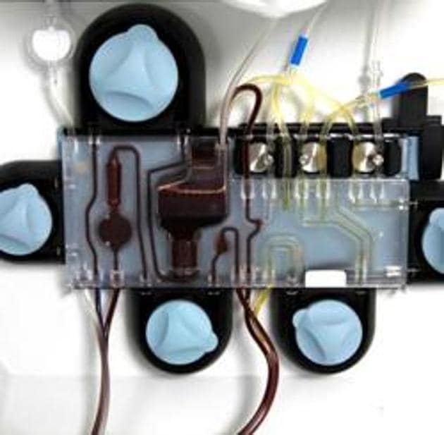 Blood donated by biologist Abdullah Can Yuce, who has recovered from coronavirus, is processed in a device for being used for plasma therapy to treat other patients.(REUTERS) Blood donated by biologist Abdullah Can Yuce, who has recovered from coronavirus, is processed in a device for being used for plasma therapy to treat other patients.(REUTERS)