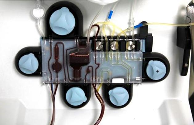 In plasma therapy, the antibody-rich plasma from a recovered patient is extracted and administered to a patient. (Representative photo) In plasma therapy, the antibody-rich plasma from a recovered patient is extracted and administered to a patient. (Representative photo)