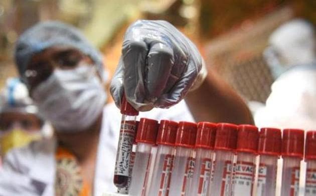 Six from other districts also tested positive in Ludhiana (Sanchit Khanna/HT PHOTO) Six from other districts also tested positive in Ludhiana (Sanchit Khanna/HT PHOTO)