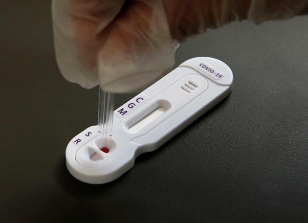 A pharmacist deposits a blood sample for an antibody rapid diagnostic test for COVID-19 at a pharmacy in Cambrai as the coronavirus disease (COVID-19) is again gaining momentum in France, July 17, 2020.(REUTERS) A pharmacist deposits a blood sample for an antibody rapid diagnostic test for COVID-19 at a pharmacy in Cambrai as the coronavirus disease (COVID-19) is again gaining momentum in France, July 17, 2020.(REUTERS)