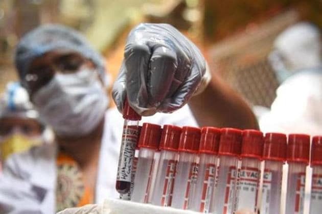 Of the total 531 cases in Mohali, 318 patients have recovered and 11 have died. A total of 202 cases are still active. (HT FIle Photo) Of the total 531 cases in Mohali, 318 patients have recovered and 11 have died. A total of 202 cases are still active. (HT FIle Photo)