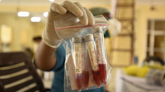 A health worker holds up swab sample collected for Covid-19 testing at the community centre in Sector 4, Gurugram on July 18. India saw a slight dip in the number of daily coronavirus disease (Covid-19) cases a day after recording 40,425 infections on July 20. The country has 1,155,191 according to the Union Heath Ministry bulletin released on July 21. (Parveen Kumar / HT Photo) A health worker holds up swab sample collected for Covid-19 testing at the community centre in Sector 4, Gurugram on July 18. India saw a slight dip in the number of daily coronavirus disease (Covid-19) cases a day after recording 40,425 infections on July 20. The country has 1,155,191 according to the Union Heath Ministry bulletin released on July 21. (Parveen Kumar / HT Photo)