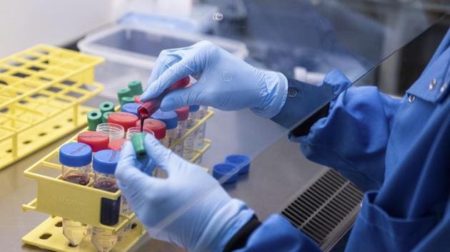 Producing vaccines and deploying them to the world’s population in the midst of a pandemic would be a massive challenge even if researchers are able to deliver one-dose inoculations. (AP file photo) Producing vaccines and deploying them to the world’s population in the midst of a pandemic would be a massive challenge even if researchers are able to deliver one-dose inoculations. (AP file photo)