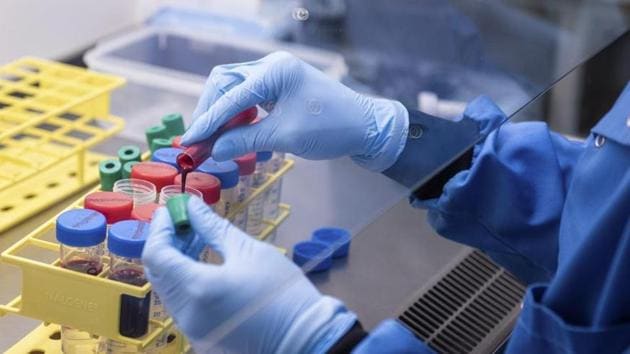 Photo released by the University of Oxford blood samples from coronavirus vaccine trials are handled inside the Jenner Institute in Oxford, England on June 25, 2020. (AP File Photo) Photo released by the University of Oxford blood samples from coronavirus vaccine trials are handled inside the Jenner Institute in Oxford, England on June 25, 2020. (AP File Photo)