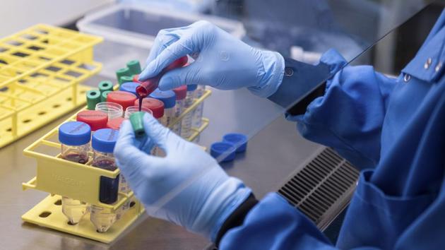 The Serum Institute of India on Tuesday said it would be starting trials of the Covid-19 vaccine candidate developed by Oxford University and British pharma major AstraZeneca by the end of August on up to 5,000 Indian volunteers after getting the necessary approval.(AP PHOTO.) The Serum Institute of India on Tuesday said it would be starting trials of the Covid-19 vaccine candidate developed by Oxford University and British pharma major AstraZeneca by the end of August on up to 5,000 Indian volunteers after getting the necessary approval.(AP PHOTO.)
