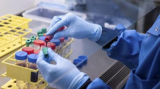 Handout photo released by the University of Oxford blood samples from coronavirus vaccine trials are handled inside the Jenner Institute in Oxford, England on June 25, 2020. (AP File Photo) Handout photo released by the University of Oxford blood samples from coronavirus vaccine trials are handled inside the Jenner Institute in Oxford, England on June 25, 2020. (AP File Photo)
