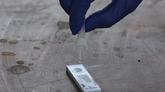 The doctor, who tested positive to Covid-19, has been undergoing treatment at a hospital in Ulhasnagar since the past eight days. ) (Parveen Kumar/HT file photo. Representative image) The doctor, who tested positive to Covid-19, has been undergoing treatment at a hospital in Ulhasnagar since the past eight days. ) (Parveen Kumar/HT file photo. Representative image)