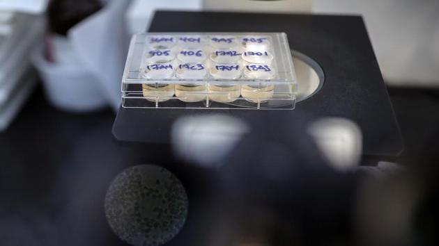 Cells that produce antibodies against the coronavirus disease (Covid-19) are seen through a microscope, in a university lab in Athens, Greece. (REUTERS) Cells that produce antibodies against the coronavirus disease (Covid-19) are seen through a microscope, in a university lab in Athens, Greece. (REUTERS)