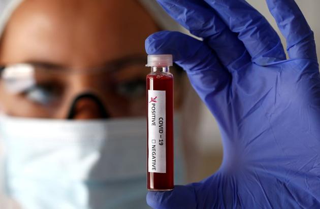 FILE PHOTO: Fake blood is seen in test tubes labelled with the coronavirus (COVID-19) in this illustration taken March 17, 2020.(REUTERS) FILE PHOTO: Fake blood is seen in test tubes labelled with the coronavirus (COVID-19) in this illustration taken March 17, 2020.(REUTERS)