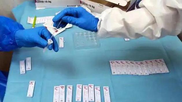 The results of the second such serological study in the city are expected by mid-August. (Bloomberg) The results of the second such serological study in the city are expected by mid-August. (Bloomberg)