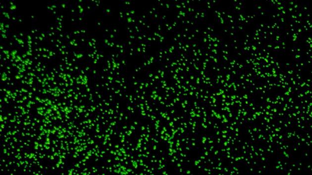 Microbes revived from 101.5 million-year-old sediment cores gathered from deep beneath the seafloor under the Pacific Ocean are seen in an undated magnified image released by the Japan Agency for Marine-Earth Science and Technology (JAMSTEC) in Kochi, Japan July 28, 2020.(JAMSTEC/Handout via REUTERS)