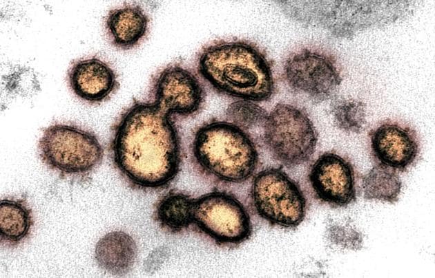 This transmission electron microscope image shows SARS-CoV-2, also known as novel coronavirus, the virus that causes Covid-19, isolated from a patient in the US.(via REUTERS) This transmission electron microscope image shows SARS-CoV-2, also known as novel coronavirus, the virus that causes Covid-19, isolated from a patient in the US.(via REUTERS)