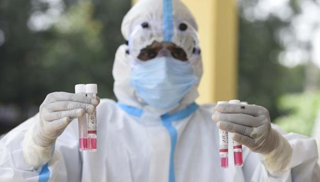 A health worker shows the collected swab sample for Reverse transcription-polymerase chain reaction (RT-PCR) for coronavirus test, at the Ayushman Bharat Health and Wellness Centre, in Wazirabad Village, near ancient Shiv Mandir in Gurugram.(Parveen Kumar/HT File Photo)