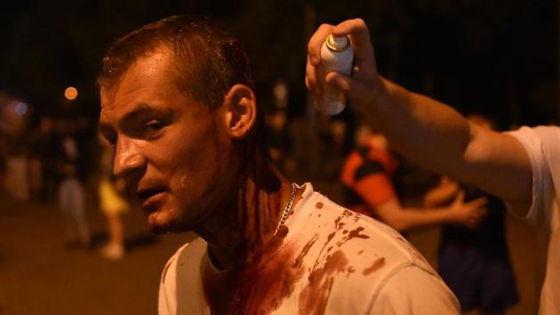 An injured man receives help during a rally of opposition supporters in Minsk on August 10. According to AP, police deployed to break up the post-election protests used batons, stun grenades, tear gas and rubber bullets. One protester died Monday amid the crackdown in Minsk, and scores were injured. (Sergei Gapon / AFP)