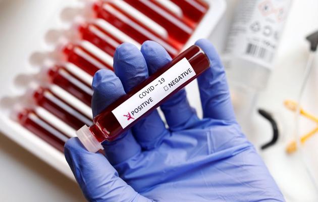 Fake blood is seen in test tubes labelled with the coronavirus result check box.(REUTERS) Fake blood is seen in test tubes labelled with the coronavirus result check box.(REUTERS)