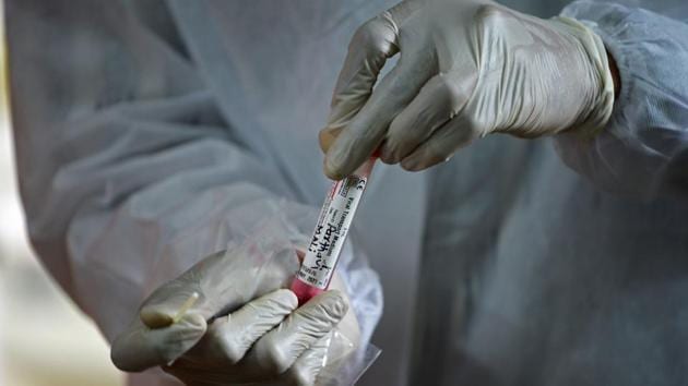 A health worker holds Covid-19 test sample at a screening camp in Mumbai on August 17. On August 18, the state government declared that the total number of recoveries in the state have risen to 437,870 while the number of those tested has gone up to 32, 64, 384. (Indranil Mukherjee / AFP)