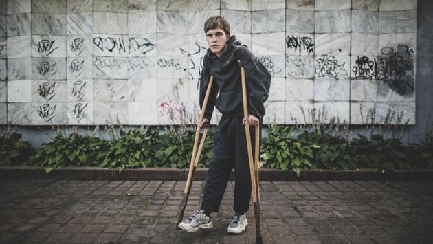 Alexander Laubert, 18, a student poses for a photo on crutches due to a broken knee after being beaten by police during a protest, in Minsk on August 18. Laubert endured two days of being beaten, trampled on, nearly suffocated and doused in gasoline before volunteers finally brought him to a hospital for treatment and a leg cast, AP reported. (Evgeniy Maloletka / AP) Alexander Laubert, 18, a student poses for a photo on crutches due to a broken knee after being beaten by police during a protest, in Minsk on August 18. Laubert endured two days of being beaten, trampled on, nearly suffocated and doused in gasoline before volunteers finally brought him to a hospital for treatment and a leg cast, AP reported. (Evgeniy Maloletka / AP)