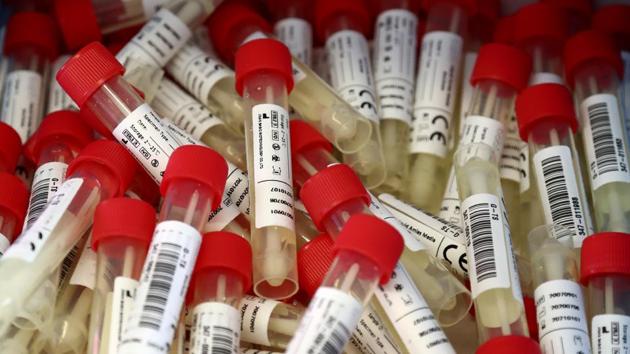 Others who tested positive include 76 patients with symptoms of influenza-like illness (ILI), 31 contacts of positive patients, 22 patients referred from the OPDs, 26 health-care workers and four domestic travellers. (AP) Others who tested positive include 76 patients with symptoms of influenza-like illness (ILI), 31 contacts of positive patients, 22 patients referred from the OPDs, 26 health-care workers and four domestic travellers. (AP)