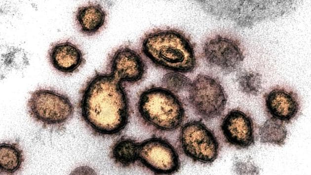 This transmission electron microscope image shows SARS-CoV-2, also known as novel coronavirus, the virus that causes COVID-19, isolated from a patient in the US.(via REUTERS) This transmission electron microscope image shows SARS-CoV-2, also known as novel coronavirus, the virus that causes COVID-19, isolated from a patient in the US.(via REUTERS)