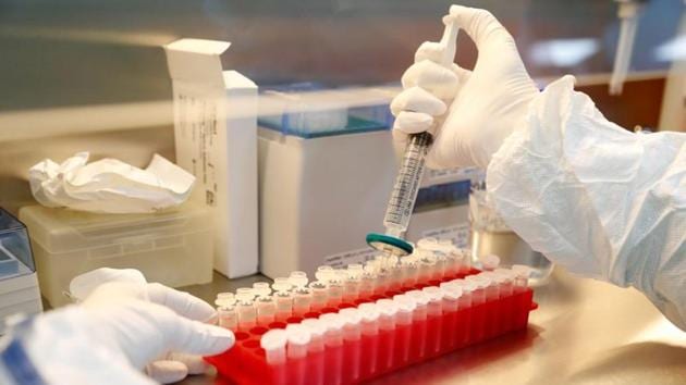 A scientist filters out samples during the research and development of a vaccine against the coronavirus disease at a laboratory of BIOCAD biotechnology company in St Petersburg, Russia. (REUTERS) A scientist filters out samples during the research and development of a vaccine against the coronavirus disease at a laboratory of BIOCAD biotechnology company in St Petersburg, Russia. (REUTERS)