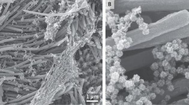 An en face image (Panel A) shows an infected ciliated cell with strands of mucus attached to the cilia tips. At higher magnification, an image (Panel B) shows the structure and density of SARS-CoV-2 virions produced by human airway epithelial cells.(Photo courtesy: New England Journal of Medicine)