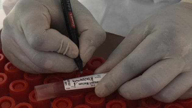 A health worker labels a test tube containing a swab sample collected for Covid-19 test at Feroz Gandhi Colony in Gurugram on September 16. On September 17, India recorded 97,894 new cases of the coronavirus (Covid-19) disease that pushed the country’s tally to 51,18,253. (Parveen Kumar / HT Photo) A health worker labels a test tube containing a swab sample collected for Covid-19 test at Feroz Gandhi Colony in Gurugram on September 16. On September 17, India recorded 97,894 new cases of the coronavirus (Covid-19) disease that pushed the country’s tally to 51,18,253. (Parveen Kumar / HT Photo)