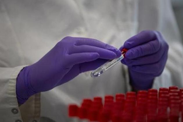 A lab technician puts a label on to a test tube while conducting research on coronavirus disease, Covid-19, at Johnson & Johnson subsidiary Janssen Pharmaceutical in Beerse, Belgium in this file photo.(AP Photo)