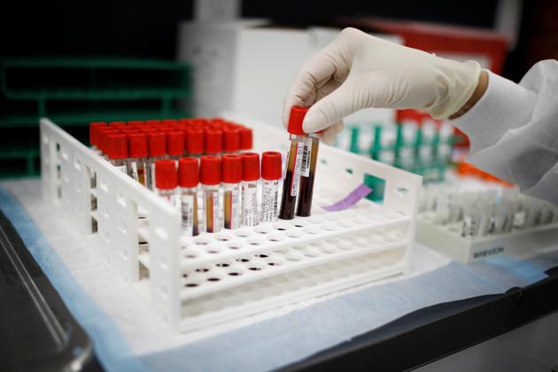 A health worker takes test tubes with plasma and blood samples after a separation process in a centrifuge during a coronavirus disease (COVID-19) vaccination study at the Research Centers of America, in Hollywood, Florida, U.S., September 24, 2020.(REUTERS)