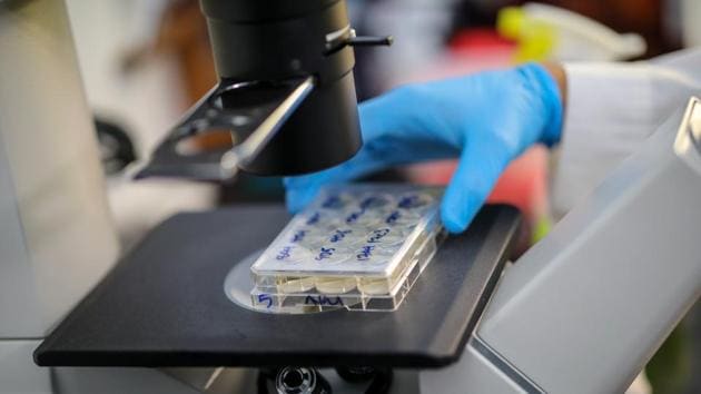 A scientist holds cells that produce antibodies against the coronavirus disease under a microscope, in a university lab in Athens, Greece. (REUTERS) A scientist holds cells that produce antibodies against the coronavirus disease under a microscope, in a university lab in Athens, Greece. (REUTERS)