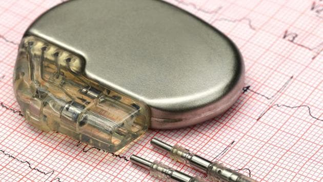 Heart diseases, chronic respiratory illnesses and strokes are among the top 3 diseases which continue to kill more citizens more than any other disease. In this picture, a pacemaker is placed above an electrocardiograph.(HT Archives) Heart diseases, chronic respiratory illnesses and strokes are among the top 3 diseases which continue to kill more citizens more than any other disease. In this picture, a pacemaker is placed above an electrocardiograph.(HT Archives)