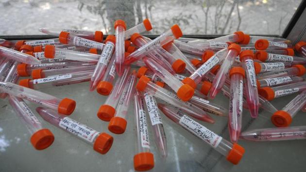 Samples collected for Covid-19 tests at the District Hospital in Sector 30, Noida on October 10. The drop in the daily case trajectory has been led by some states also responsible for the spike in cases—Maharashtra, Tamil Nadu, Andhra Pradesh and Delhi. (Sunil Ghosh / HT Photo) Samples collected for Covid-19 tests at the District Hospital in Sector 30, Noida on October 10. The drop in the daily case trajectory has been led by some states also responsible for the spike in cases—Maharashtra, Tamil Nadu, Andhra Pradesh and Delhi. (Sunil Ghosh / HT Photo)