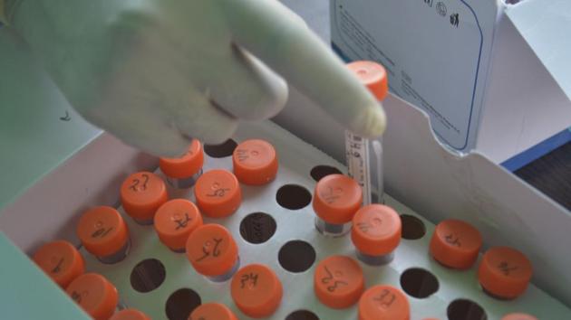 A health worker handles samples collected for Covid-19 testing at MMG hospital in Ghaziabad, India on Sunday, October 11, 2020. (Photo by Sakib Ali /Hindustan Times) A health worker handles samples collected for Covid-19 testing at MMG hospital in Ghaziabad, India on Sunday, October 11, 2020. (Photo by Sakib Ali /Hindustan Times)