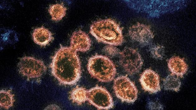 Rocky Mountain Laboratories shows SARS-CoV-2 virus particles which causes COVID-19, isolated from a patient in the U.S., emerging from the surface of cells cultured in a lab.(AP) Rocky Mountain Laboratories shows SARS-CoV-2 virus particles which causes COVID-19, isolated from a patient in the U.S., emerging from the surface of cells cultured in a lab.(AP)