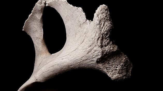 The image shows a bone. (Representative image) (Unsplash) The image shows a bone. (Representative image) (Unsplash)