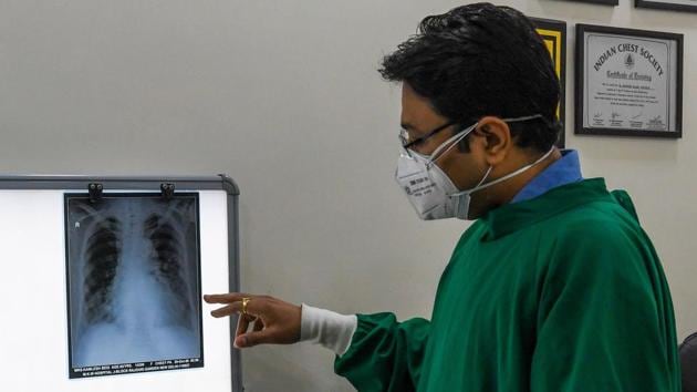 Lung specialist Davinder Kundra checks an x-ray of a patient at his Breathe Better clinic in New Delhi on November 5. Poor air quality may result in the aggravation of asthma, COPD, high BP and even cardiovascular diseases. Merely walking could result in health complications due to the high concentration of particulate matter (PM) 2.5 in Delhi’s air. (Prakash Singh / AFP)