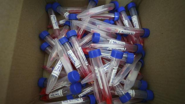Nasal and mouth swab samples collected from students at St. Joseph’s College in Bengaluru on November 16. The single-day peak in coronavirus cases was reported on September 17 with 97,984 fresh Covid-19 cases and since then India has been witnessing a decline in the caseload. (Aijaz Rahi / AP) Nasal and mouth swab samples collected from students at St. Joseph’s College in Bengaluru on November 16. The single-day peak in coronavirus cases was reported on September 17 with 97,984 fresh Covid-19 cases and since then India has been witnessing a decline in the caseload. (Aijaz Rahi / AP)