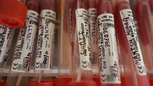 Reverse transcription-polymerase chain reaction (RT-PCR) test is considered to be the most reliable for Covid-19 testing.(HT Photo) Reverse transcription-polymerase chain reaction (RT-PCR) test is considered to be the most reliable for Covid-19 testing.(HT Photo)