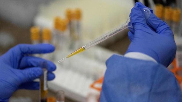 The hospital has already earmarked a 5,000 square metre facility, which has to be retrofitted with freezers and power backup, for the storage of the Covid-19 vaccines.(AFP) The hospital has already earmarked a 5,000 square metre facility, which has to be retrofitted with freezers and power backup, for the storage of the Covid-19 vaccines.(AFP)