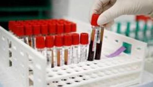 UK’s medicine regulator said anyone with a history of anaphylaxis to a medicine or food should not get the Pfizer-BioNTech Covid-19 vaccine. (REUTERS) UK’s medicine regulator said anyone with a history of anaphylaxis to a medicine or food should not get the Pfizer-BioNTech Covid-19 vaccine. (REUTERS)