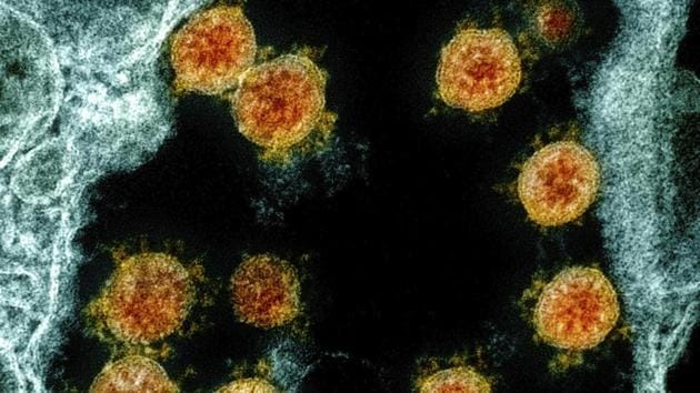 This electron microscope image made available and color-enhanced by the National Institute of Allergy and Infectious Diseases Integrated Research Facility in Fort Detrick, Md., in 2020, shows Novel Coronavirus SARS-CoV-2 virus particles, orange, isolated from a patient.(AP)